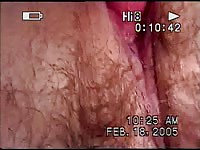 Slut's hairy pussy got fucked in dog sex